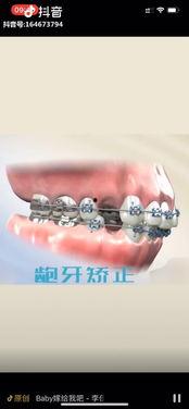 一牙在线视频,揭秘牙齿健康与口腔护理的奥秘